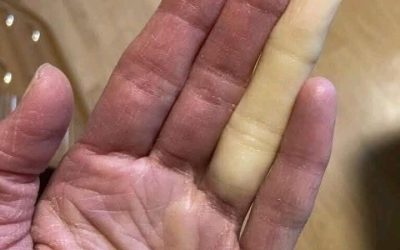 Det här är konsekvenserna av att sova med… Se mer