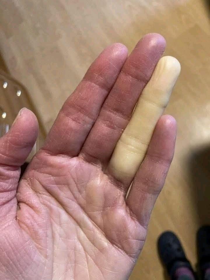 Det här är konsekvenserna av att sova med… Se mer