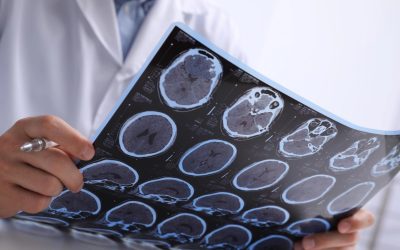 Detta “tysta” symptom tyder på att du kan vara på väg att utveckla cancer