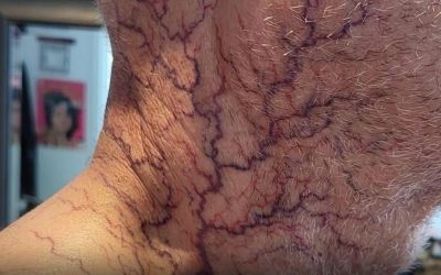Det här är konsekvenserna av att sova med…Se mer