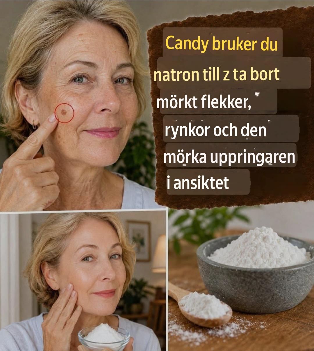 Hur man använder bikarbonat för att ta bort mörka fläckar, rynkor och mörka ringar i ansiktet. Recept i första kommentaren.
