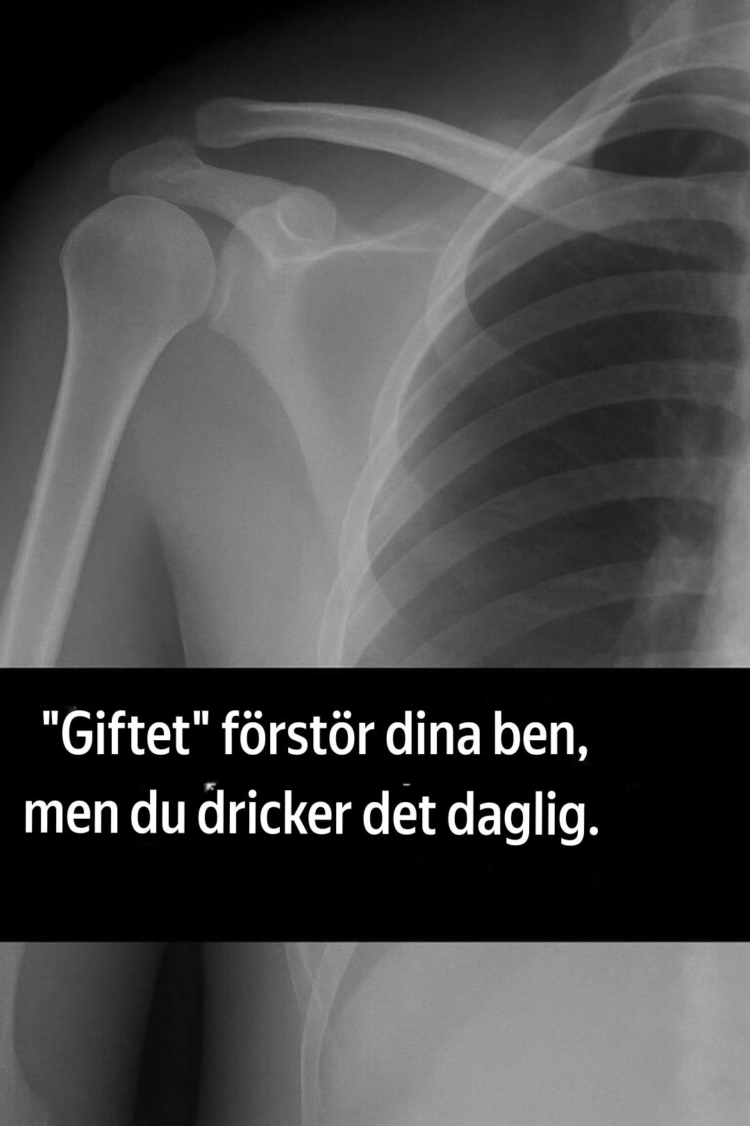 Detta ”gift” förstör dina ben – och du dricker det varje dag!