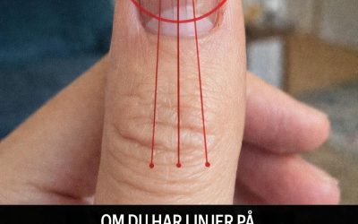 Nagellinjer: Vad de kan avslöja om din hälsa