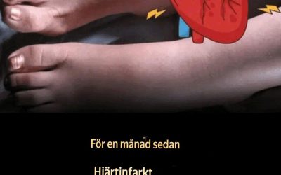 En månad före en hjärtattack varnar dina fötter dig för dessa sex tecken.